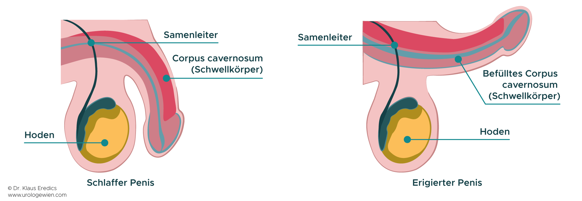 problem mit erektion